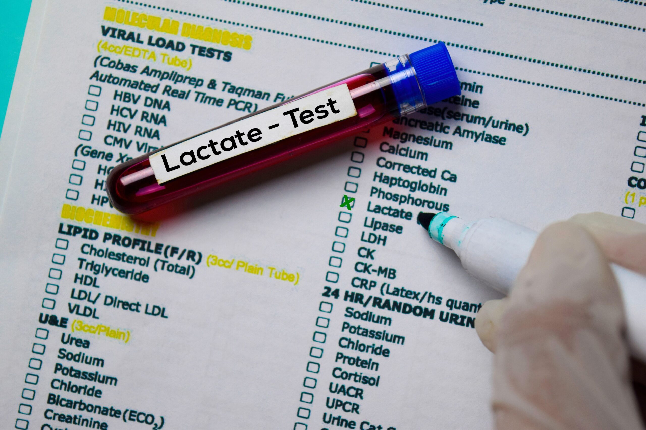 Lactate resized